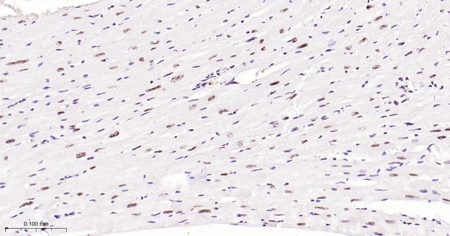 磷酸化p38MAPK重组兔单抗-bsm-63316R