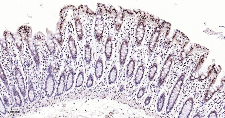 磷酸化p38MAPK重组兔单抗-bsm-63316R