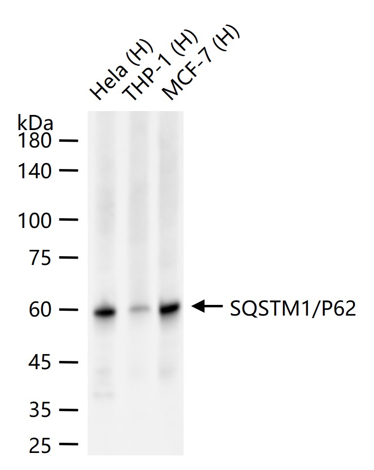 泛素结合蛋白P62重组兔单抗-bsm-63328R