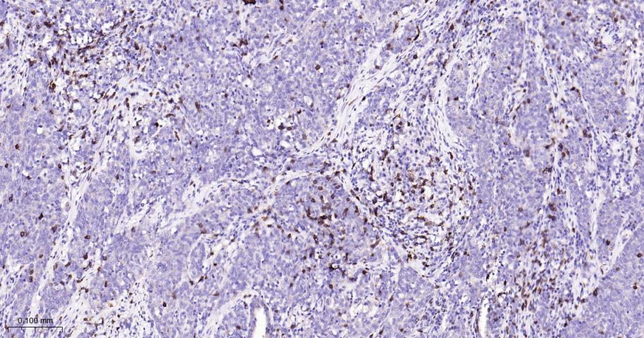 CD8重组兔单抗-bsm-61078R
