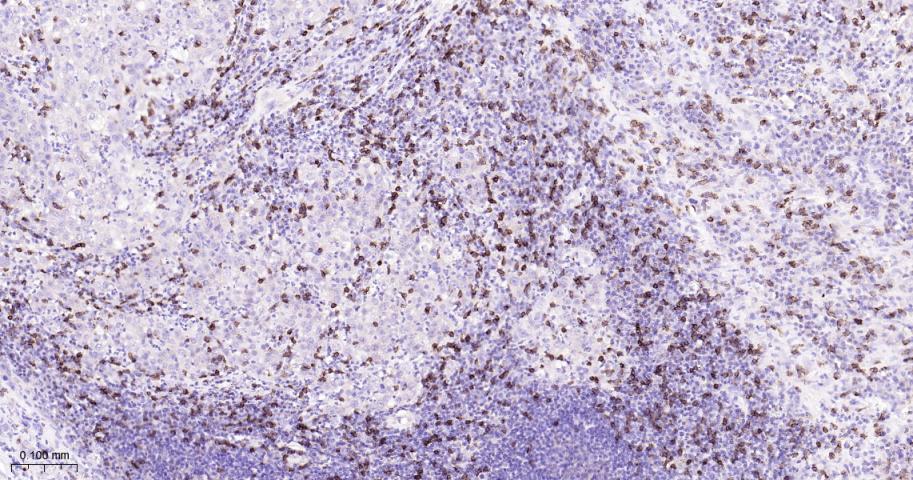 CD8重组兔单抗-bsm-61078R