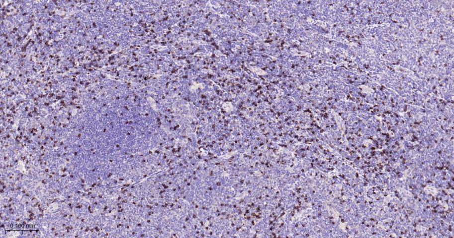CD8重组兔单抗-bsm-61078R