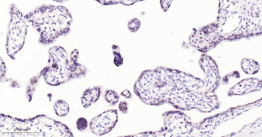 活化转录因子3重组兔单抗-bsm-60931R