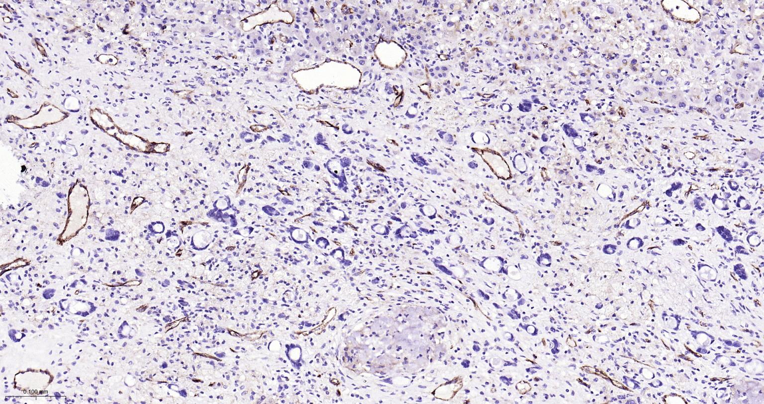血小板内皮细胞黏附分子-1重组兔单抗-bsm-52428R