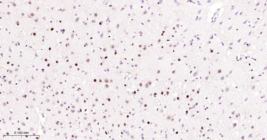 选择性剪接因子3B亚基1重组兔单抗-bsm-61871R
