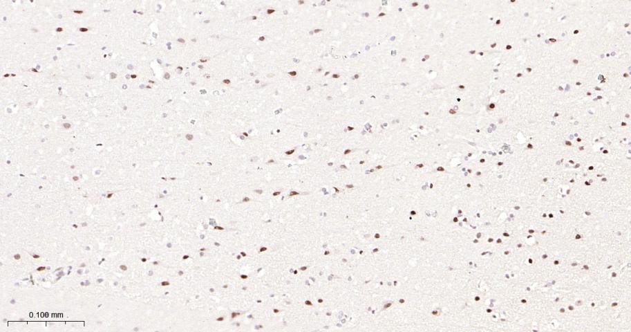 选择性剪接因子3B亚基1重组兔单抗-bsm-61871R