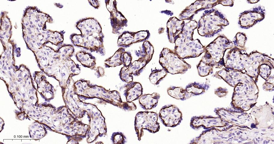 细胞膜钙ATP酶1重组兔单抗-bsm-62073R