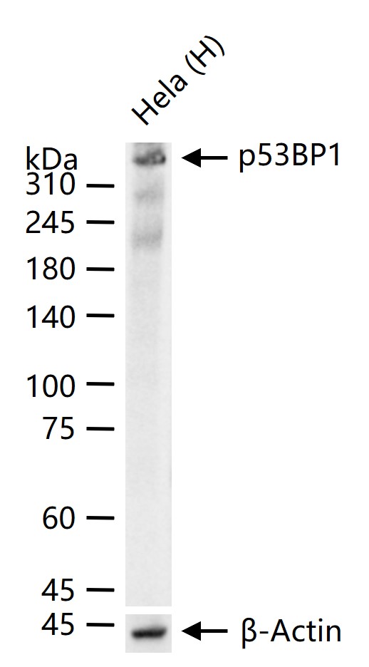 p53结合蛋白1重组兔单抗-bsm-61471R