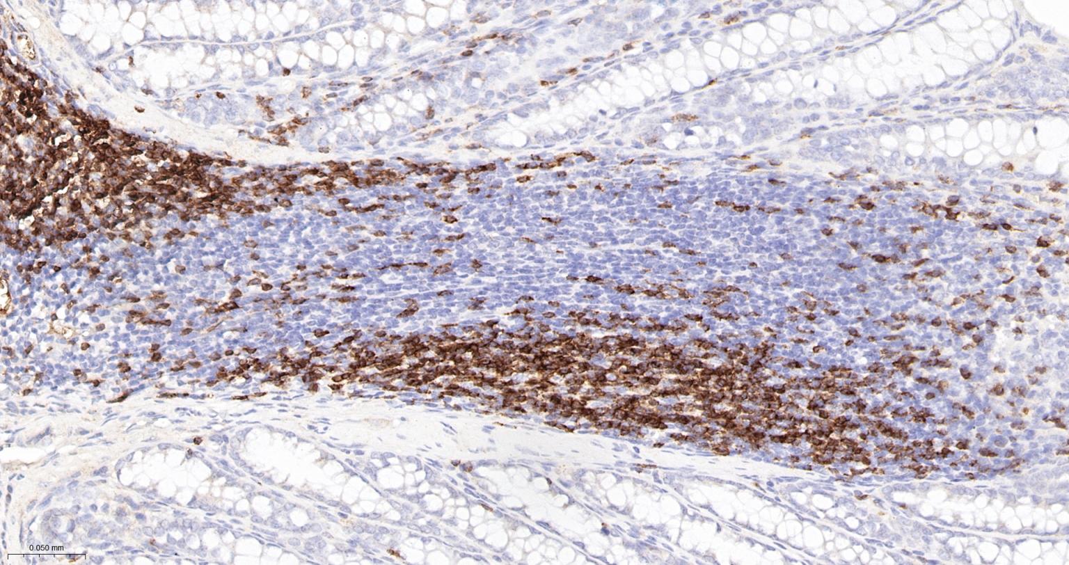 CD3/CD3-ε重组兔单抗-bsm-60002R