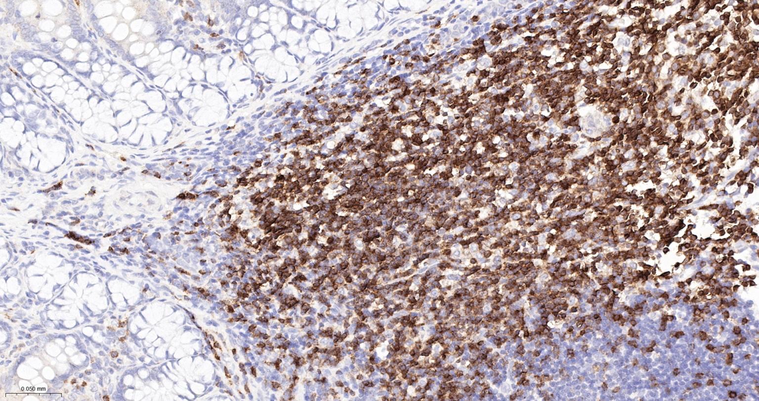 CD3/CD3-ε重组兔单抗-bsm-60002R