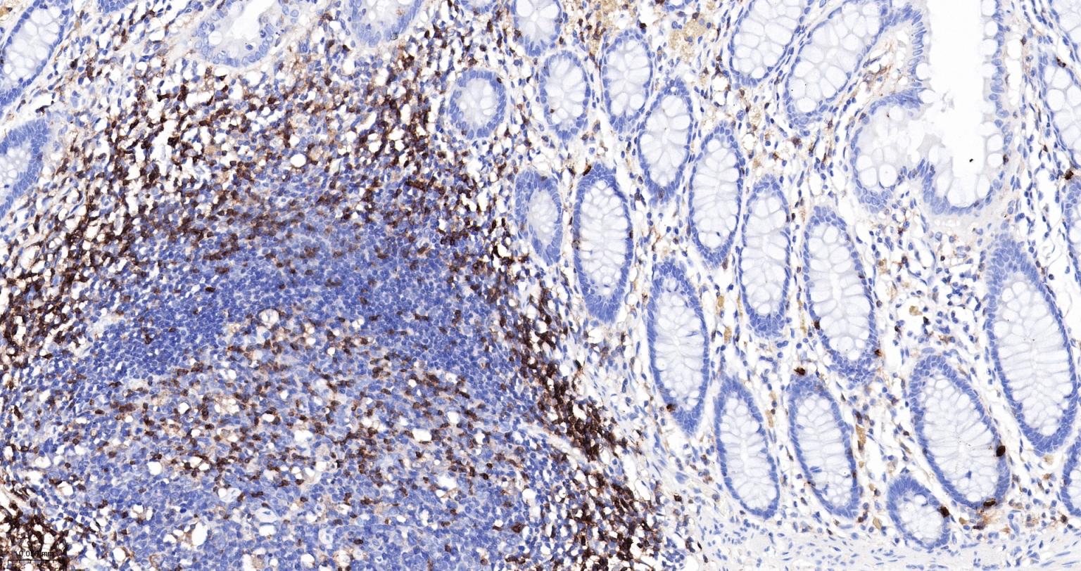 CD3/CD3-ε重组兔单抗-bsm-60002R