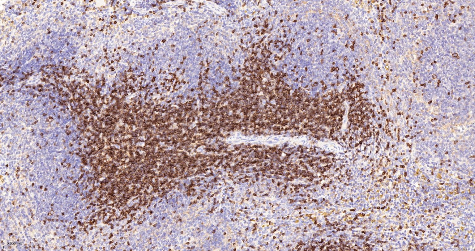 CD3/CD3-ε重组兔单抗-bsm-60002R