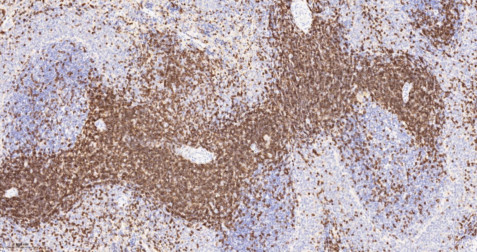CD3/CD3-ε重组兔单抗-bsm-60002R