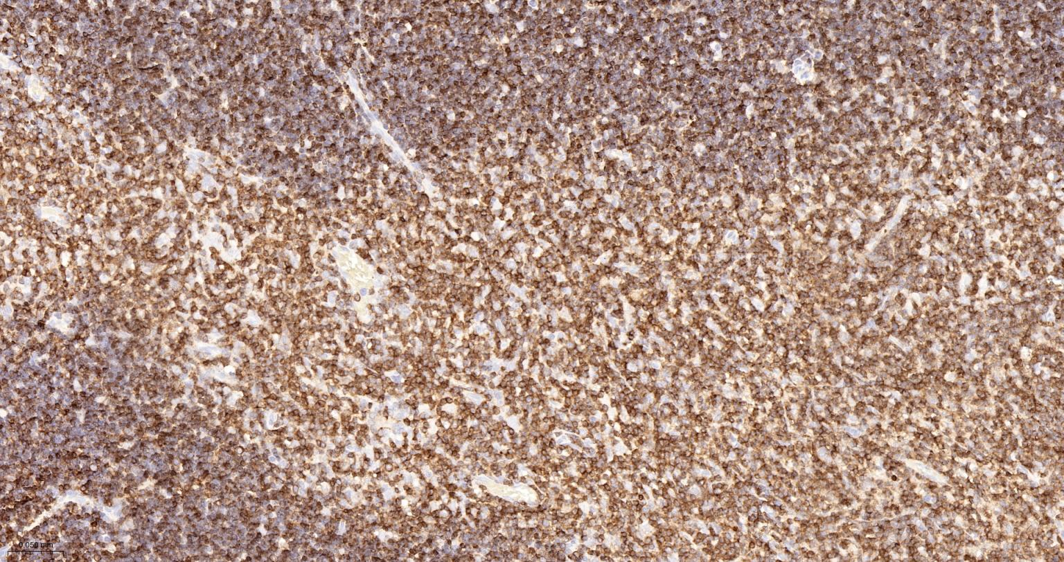CD3/CD3-ε重组兔单抗-bsm-60002R