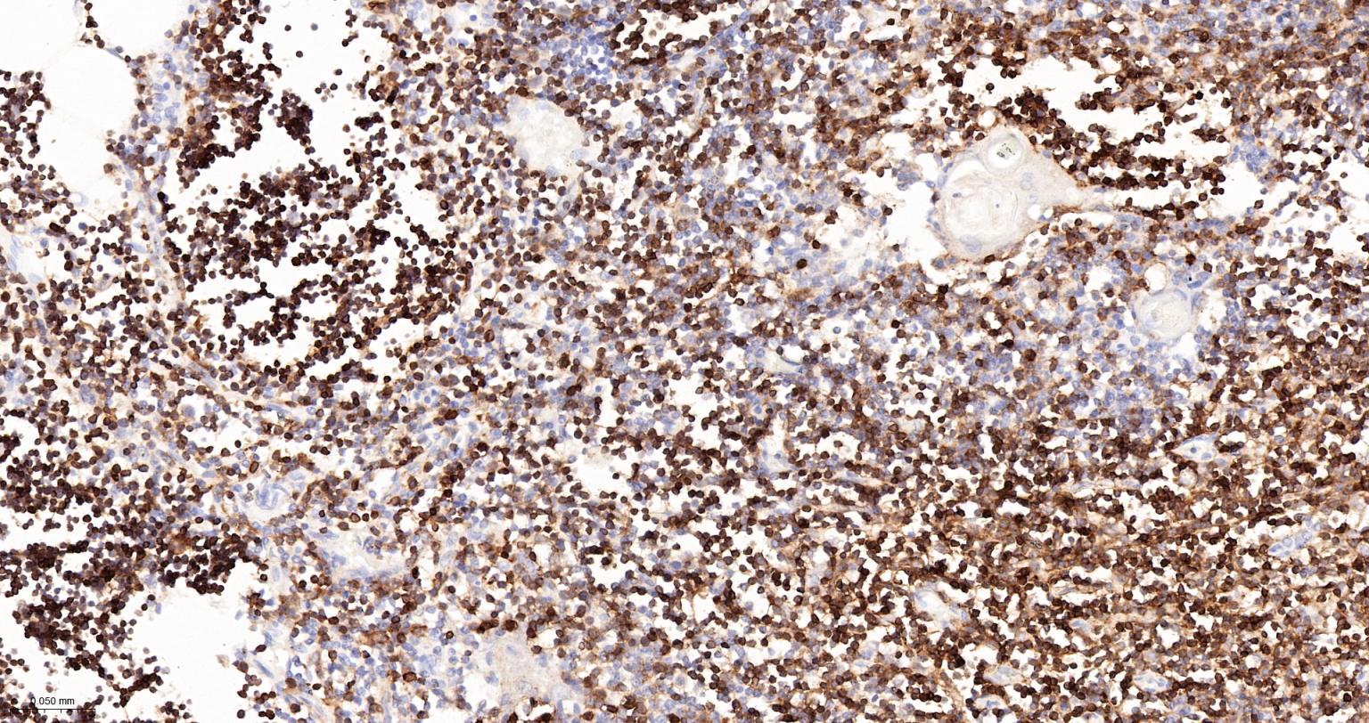CD3/CD3-ε重组兔单抗-bsm-60002R