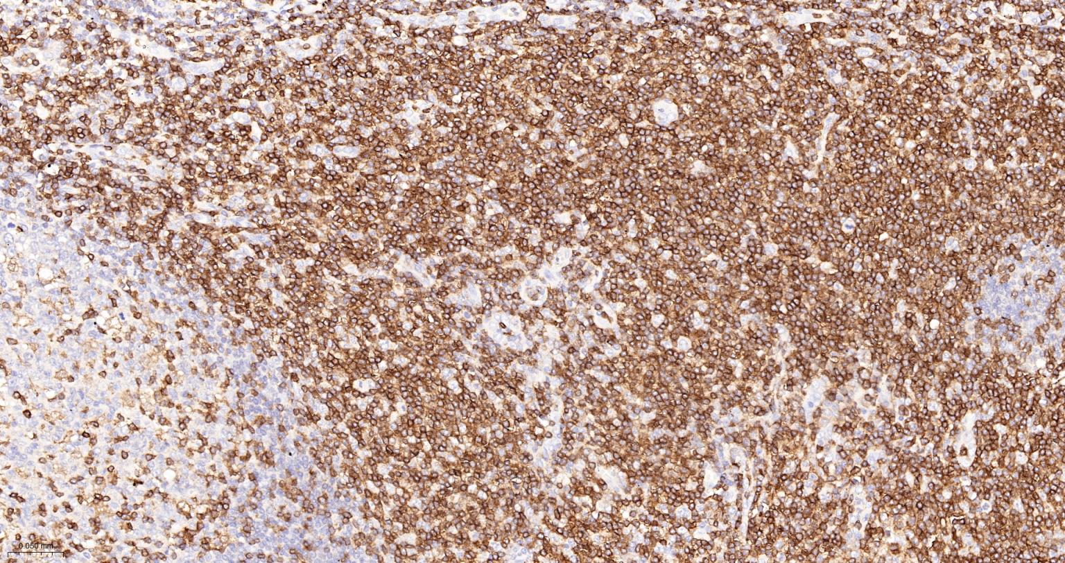 CD3/CD3-ε重组兔单抗-bsm-60002R