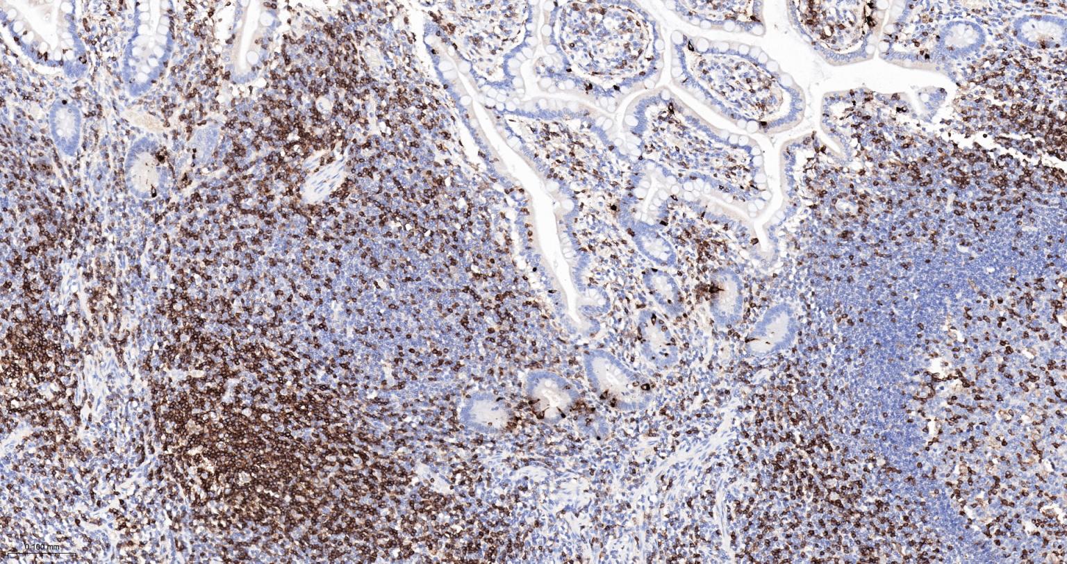 CD3/CD3-ε重组兔单抗-bsm-60002R