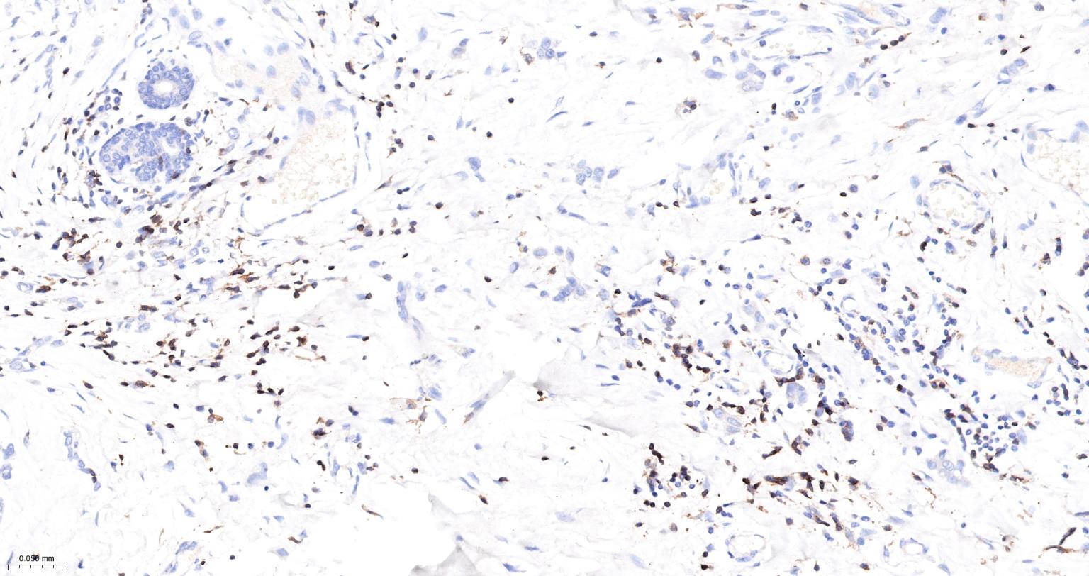 CD3/CD3-ε重组兔单抗-bsm-60002R