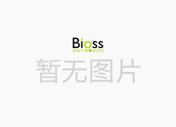 叉头蛋白P1重组兔单抗-bsm-52078R