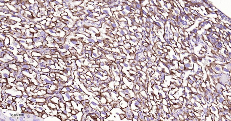 整合素α5（CD49e）重组兔单抗-bsm-61357R
