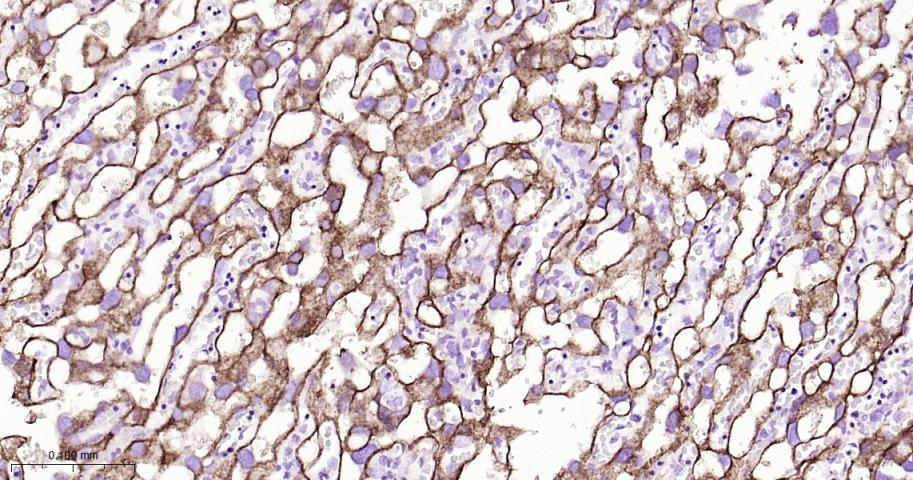 整合素α5（CD49e）重组兔单抗-bsm-61357R