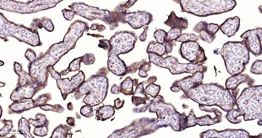 整合素α5（CD49e）重组兔单抗-bsm-61357R