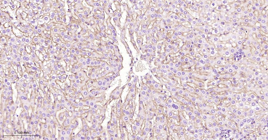 整合素α5（CD49e）重组兔单抗-bsm-61357R