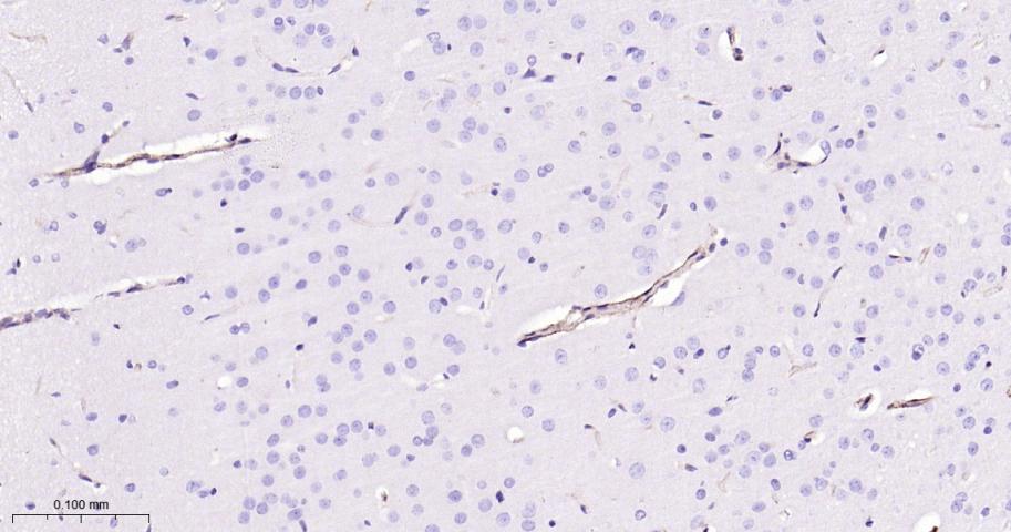整合素α5（CD49e）重组兔单抗-bsm-61357R