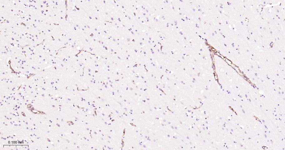 整合素α5（CD49e）重组兔单抗-bsm-61357R
