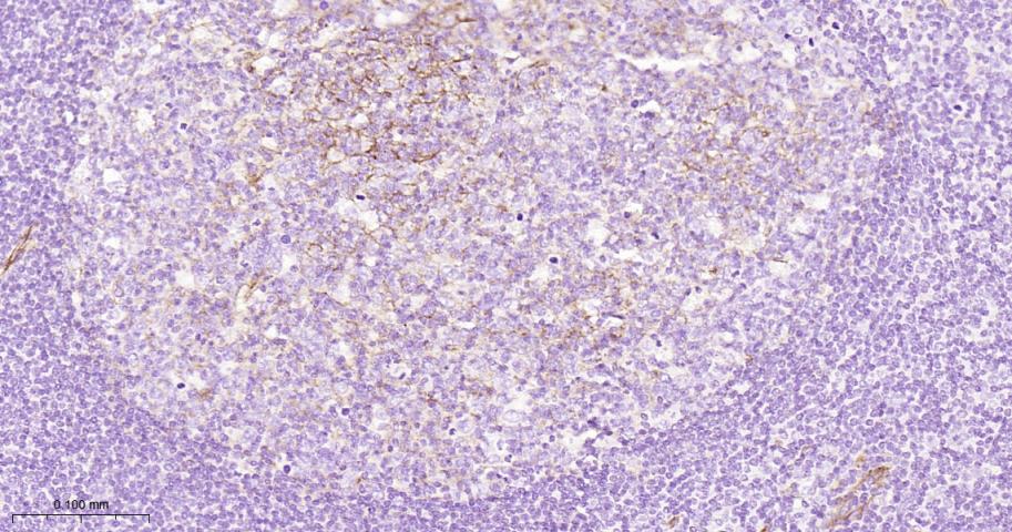 整合素α5（CD49e）重组兔单抗-bsm-61357R