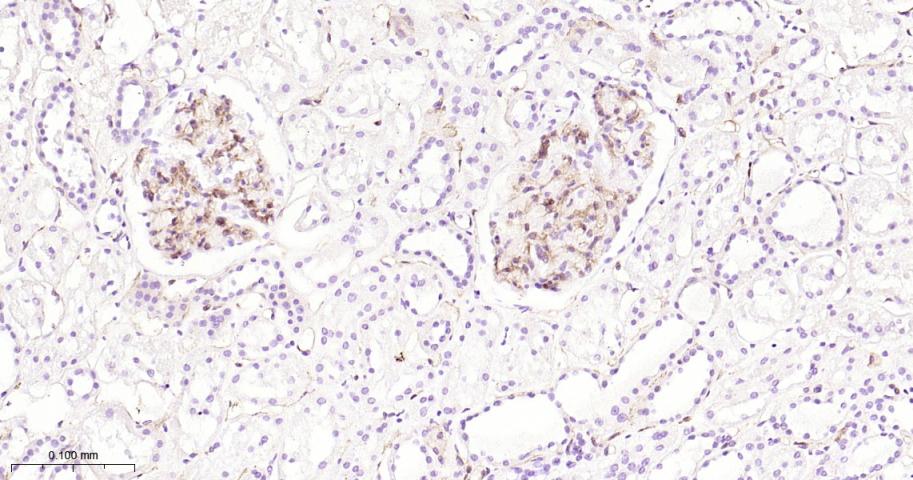 整合素α5（CD49e）重组兔单抗-bsm-61357R