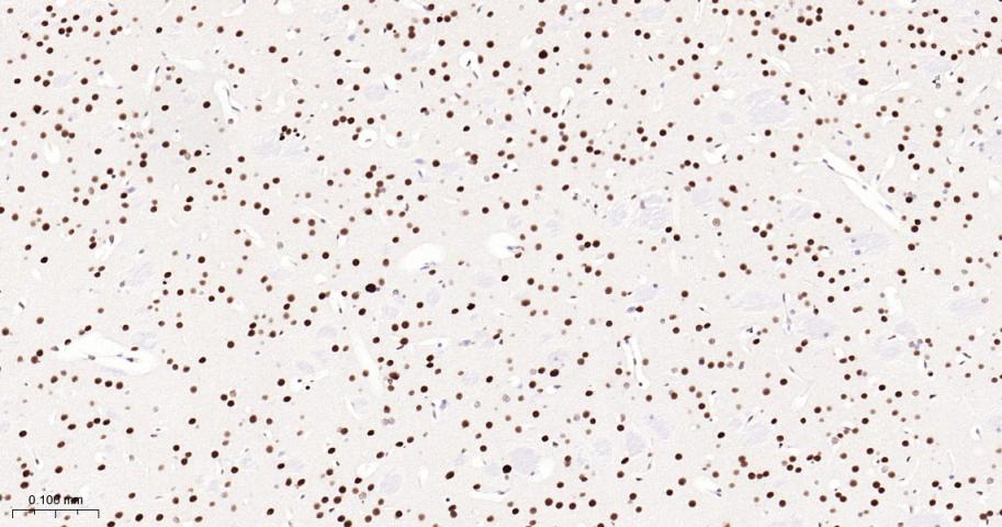 p53结合蛋白1重组兔单抗-bsm-61471R