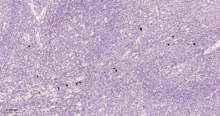 hIgG4重组兔单抗-bsm-63127R