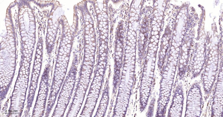 真核启动因子2α(eIFα2)兔单克隆抗体-bsm-60003R