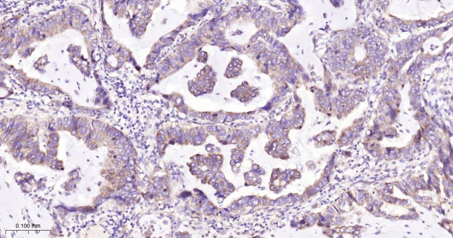 真核启动因子2α(eIFα2)兔单克隆抗体-bsm-60003R
