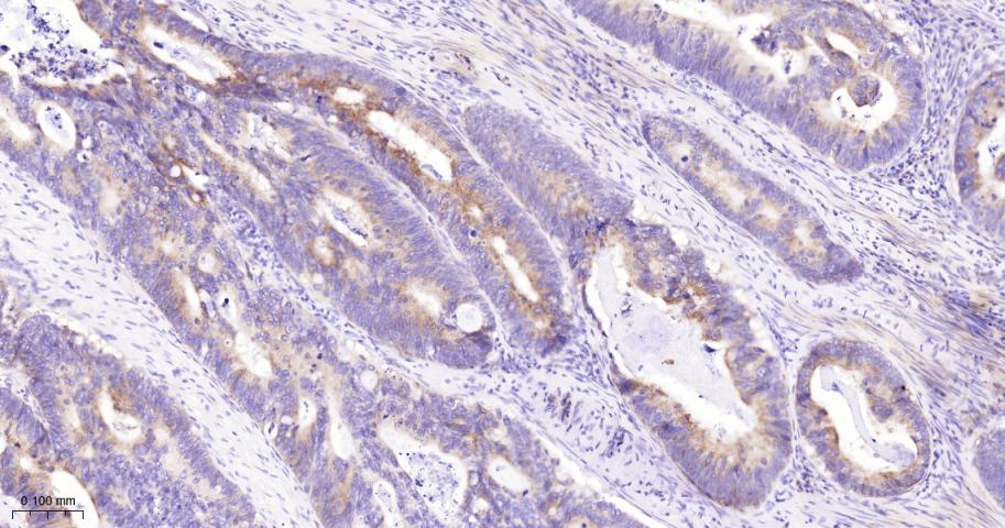 真核启动因子2α(eIFα2)兔单克隆抗体-bsm-60003R