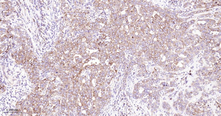 真核启动因子2α(eIFα2)兔单克隆抗体-bsm-60003R
