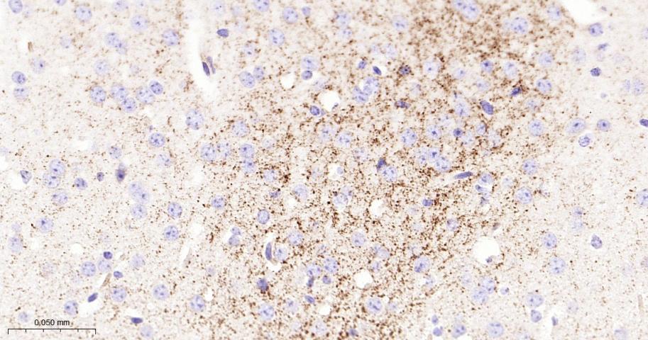 脱帽酶1A重组兔单抗-bsm-61822R