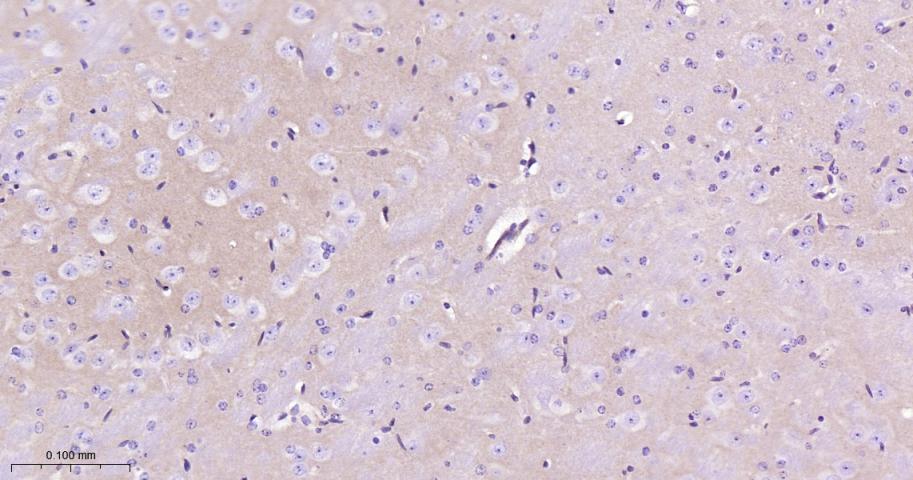 钙粘蛋白6重组兔单抗-bsm-61762R