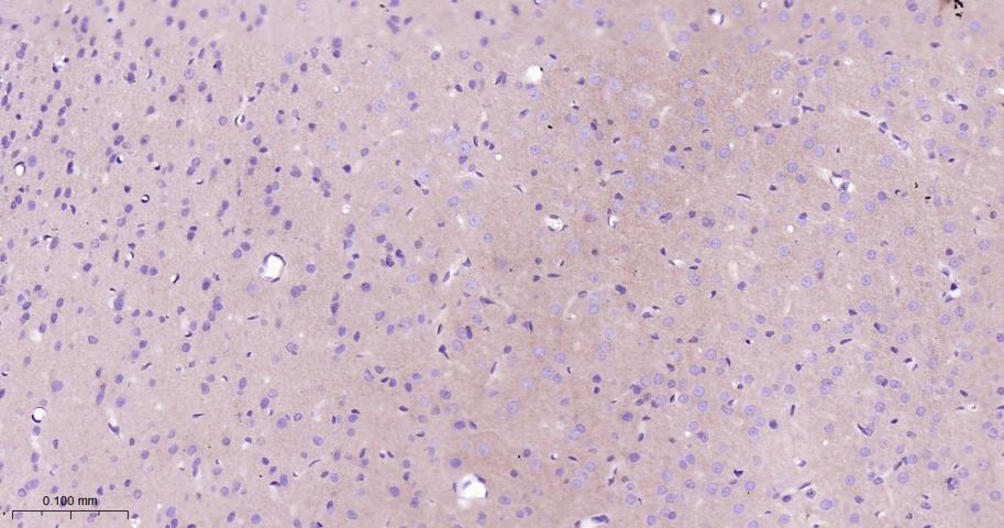 钙粘蛋白6重组兔单抗-bsm-61762R