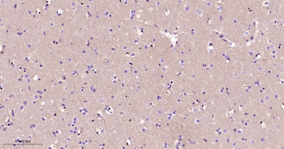 钙粘蛋白6重组兔单抗-bsm-61762R
