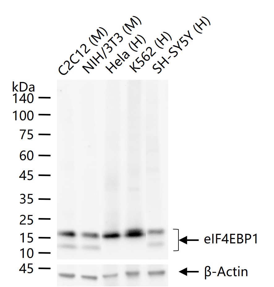 eIF4E结合蛋白重组兔单抗-bsm-63191R
