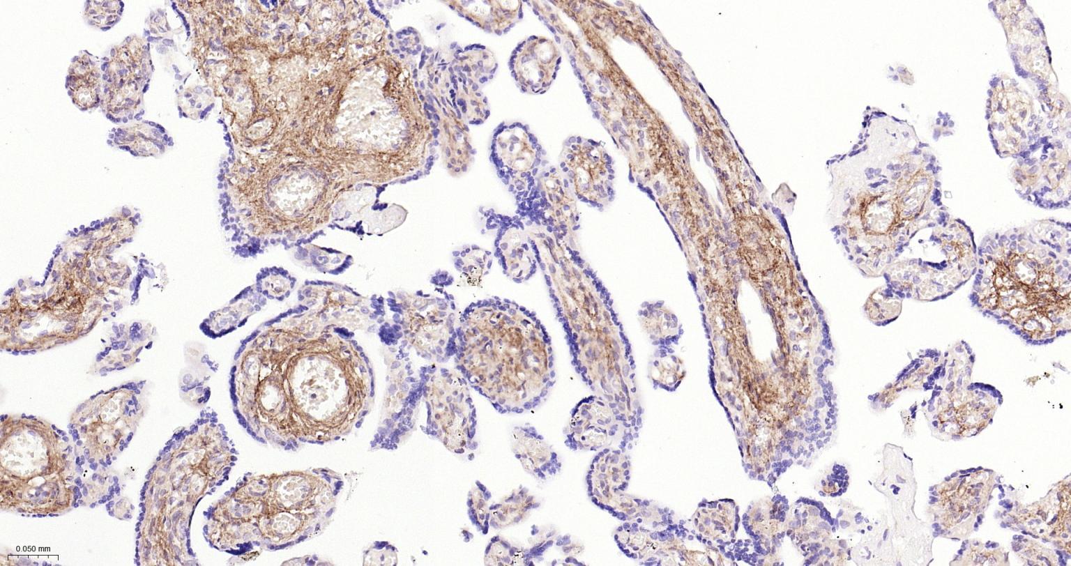 I型胶原重组兔单抗-bsm-52478R
