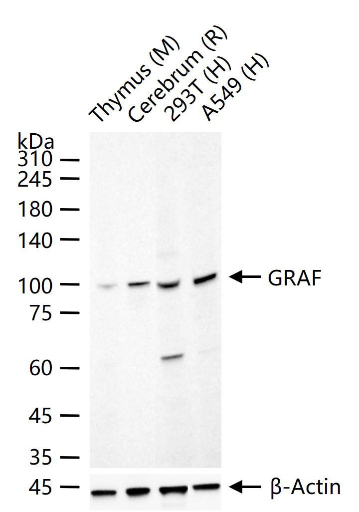 Rho GTP酶激活蛋白26重组兔单抗-bsm-62542R