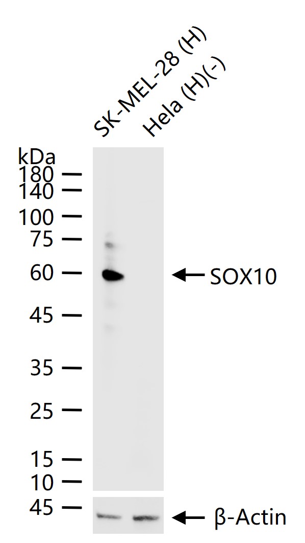 转录因子SOX10重组兔单抗-bsm-60329R