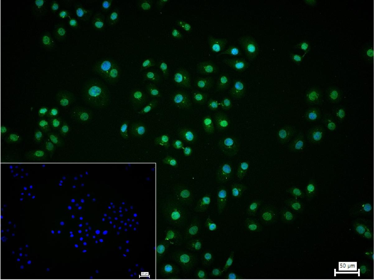 缺氧诱导因子1α /低氧诱导因子-1抗体-bs-0737R