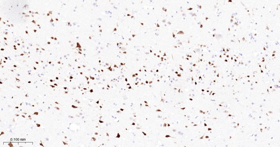 神经元核抗原重组兔单抗-bsm-52268R