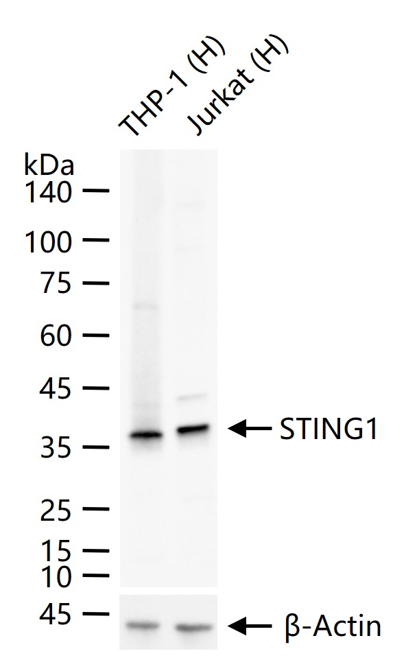 跨膜蛋白173重组兔单抗-bsm-60326R