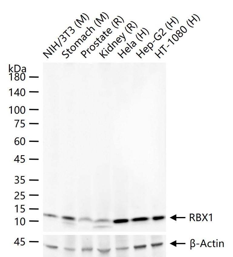 环指蛋白75重组兔单抗-bsm-60704R