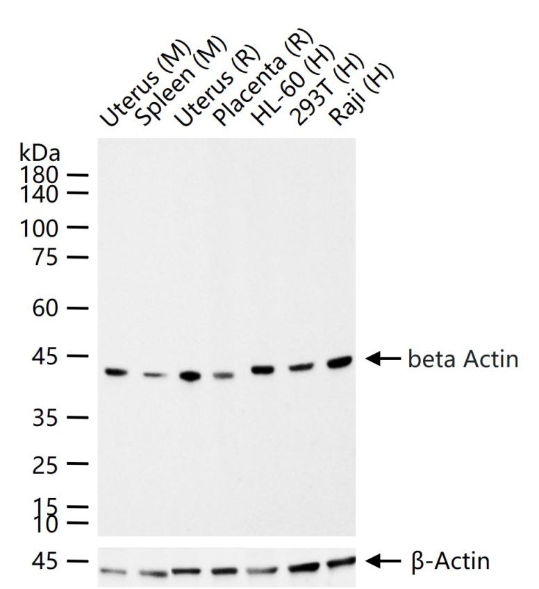 β-肌动蛋白/β-Actin（内参）重组兔单抗-bsm-63325R